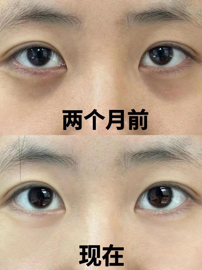 果最好？别太会挑十款实力很强的眼霜OG真人游戏眼霜哪个牌子抗皱去皱效(图9)